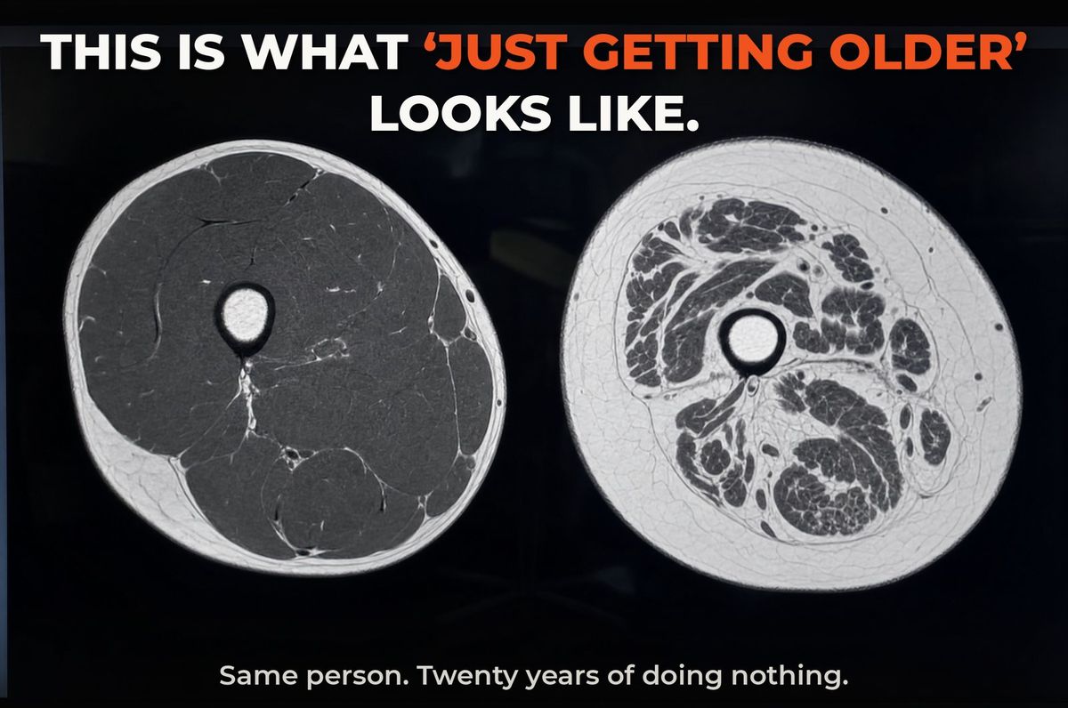 MRI cross-sections of a thigh at 55 and 75 showing muscle loss